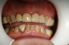 CEREC 3 A